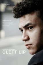 Watch Cleft Lip Watch123movies
