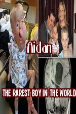 Watch Aidan The Rarest Boy In The World Watch123movies