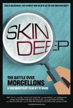 Watch Skin Deep: The Battle Over Morgellons Watch123movies