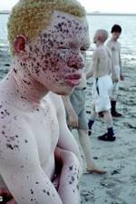 Watch Albino United Watch123movies