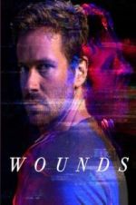 Watch Wounds Watch123movies