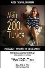 Watch The Man With The 200lb Tumor Watch123movies