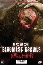 Watch TNA Wrestling: Best of the Bloodiest Brawls - Scars and Stitches Watch123movies