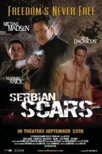 Watch Serbian Scars Watch123movies
