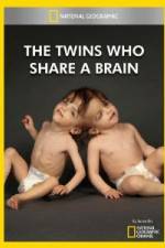 Watch National Geographic The Twins Who Share A Brain Watch123movies