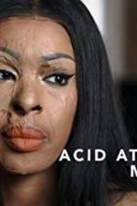 Watch Acid Attack: My Story Watch123movies